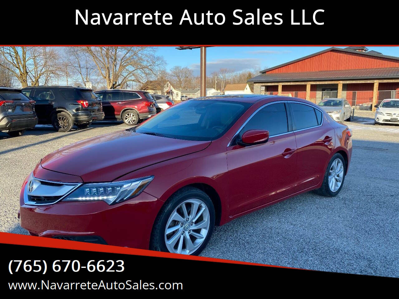 2017 ACURA ILX